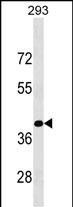 Rabbit Polyclonal Antibody to KLF15