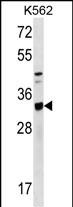 Rabbit Polyclonal Antibody to TIPRL