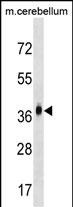 Rabbit Polyclonal Antibody to MMD2 (N-term)
