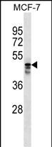 Rabbit Polyclonal Antibody to MUDEN