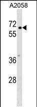 Rabbit Polyclonal Antibody to PYRD2 (N-term)