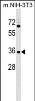 Rabbit Polyclonal Antibody to CCDC75 (N-term)