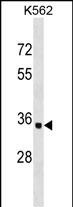 Rabbit Polyclonal Antibody to OR10AD1