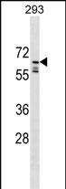 Rabbit Polyclonal Antibody to PPIL2