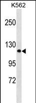 Rabbit Polyclonal Antibody to PCDHA2 (N-term)