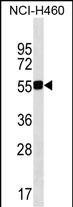 Rabbit Polyclonal Antibody to QRSL1 (N-term)