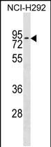 Rabbit Polyclonal Antibody to ZNF551