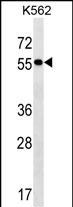 Rabbit Polyclonal Antibody to FRMD8 (N-term)