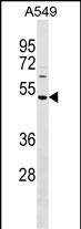 Rabbit Polyclonal Antibody to HAUS8 (N-term)