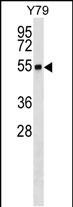 Rabbit Polyclonal Antibody to RNF26