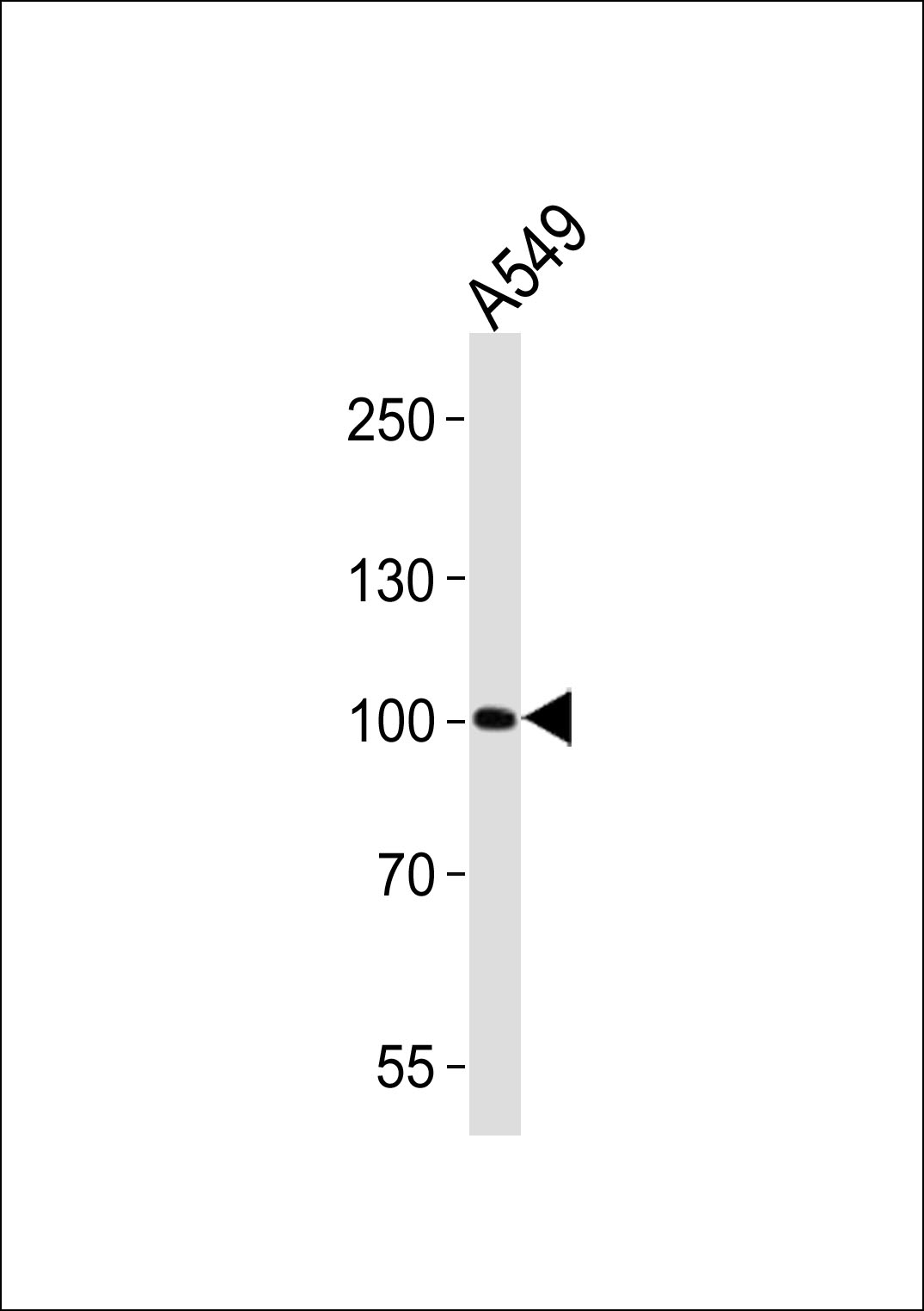 Rabbit Polyclonal Antibody to ZNF287 (N-term)