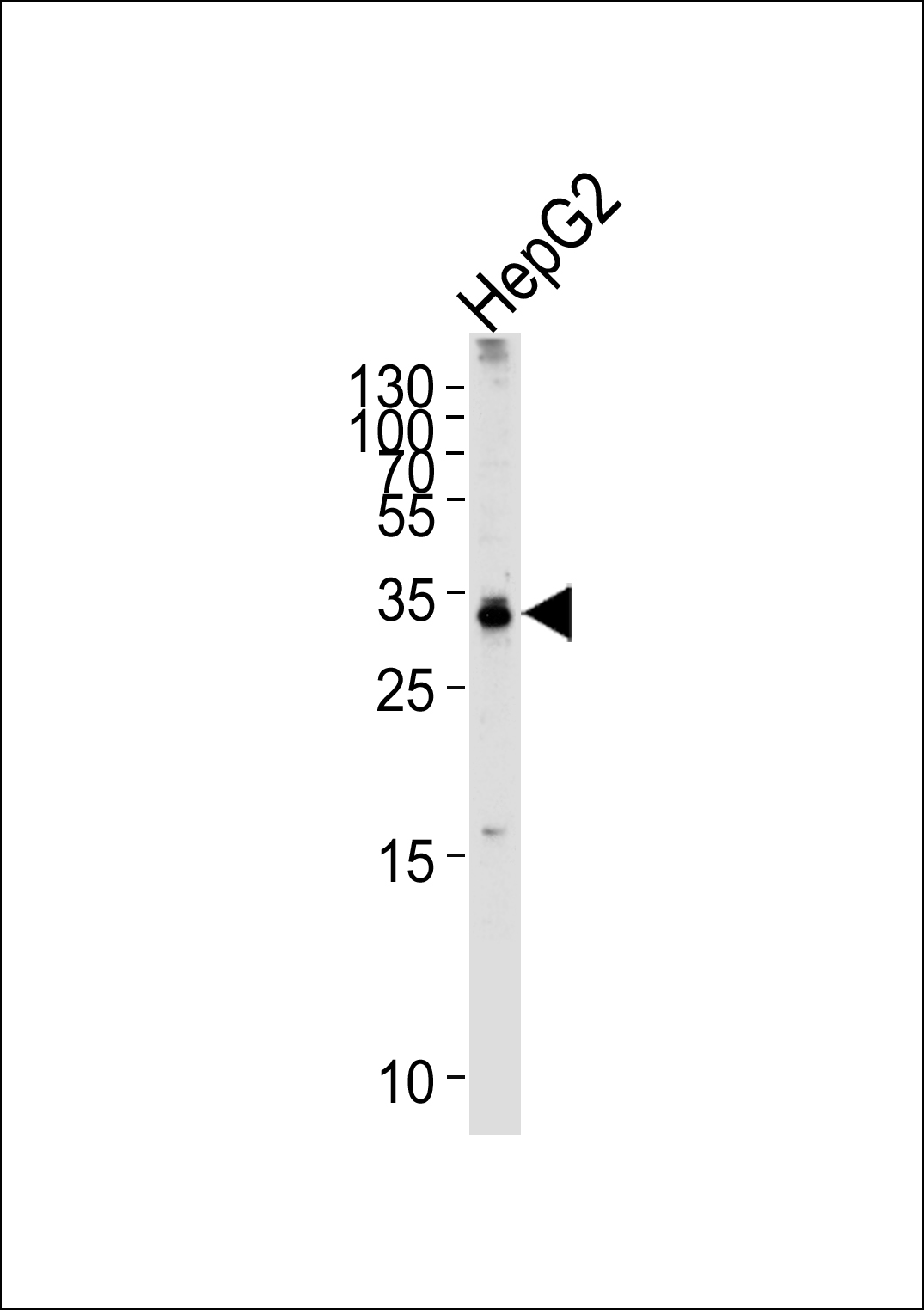 Rabbit Polyclonal Antibody to TCEAL2 (N-term)
