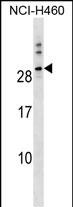 Rabbit Polyclonal Antibody to TTYH1 (N-term)