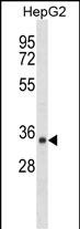 Rabbit Polyclonal Antibody to SDR39U1 (N-term)