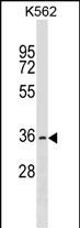 Rabbit Polyclonal Antibody to OR2AG2 (N-term)