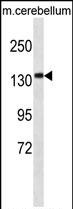 Rabbit Polyclonal Antibody to CAMSAP3 (N-term)