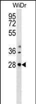 Rabbit Polyclonal Antibody to THAP10 (N-term)
