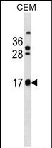 Rabbit Polyclonal Antibody to CB083