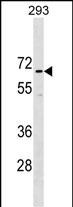 Rabbit Polyclonal Antibody to CCDC151 (N-term)