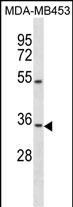 Rabbit Polyclonal Antibody to OSTM1