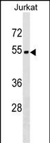 Rabbit Polyclonal Antibody to ZNF703