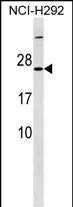 Rabbit Polyclonal Antibody to MRPS23