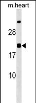 Rabbit Polyclonal Antibody to MED9
