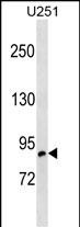 Rabbit Polyclonal Antibody to OSBPL10