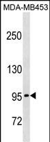 Rabbit Polyclonal Antibody to PCDHGA5 (N-term)