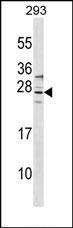 Rabbit Polyclonal Antibody to SIRPD
