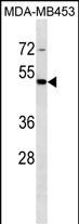 Rabbit Polyclonal Antibody to STAC