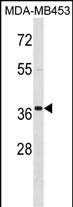 Rabbit Polyclonal Antibody to MEOX2