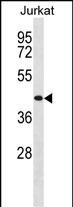 Rabbit Polyclonal Antibody to TRHR