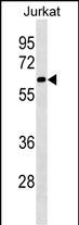 Rabbit Polyclonal Antibody to SLU7 (N-term)
