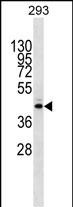 Rabbit Polyclonal Antibody to METTL2B (N-term)