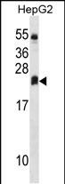 Rabbit Polyclonal Antibody to DHRS4L2