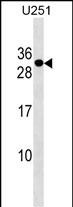 Rabbit Polyclonal Antibody to POMZP3 (N-term)