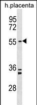 Rabbit Polyclonal Antibody to PAPD5 (N-term)