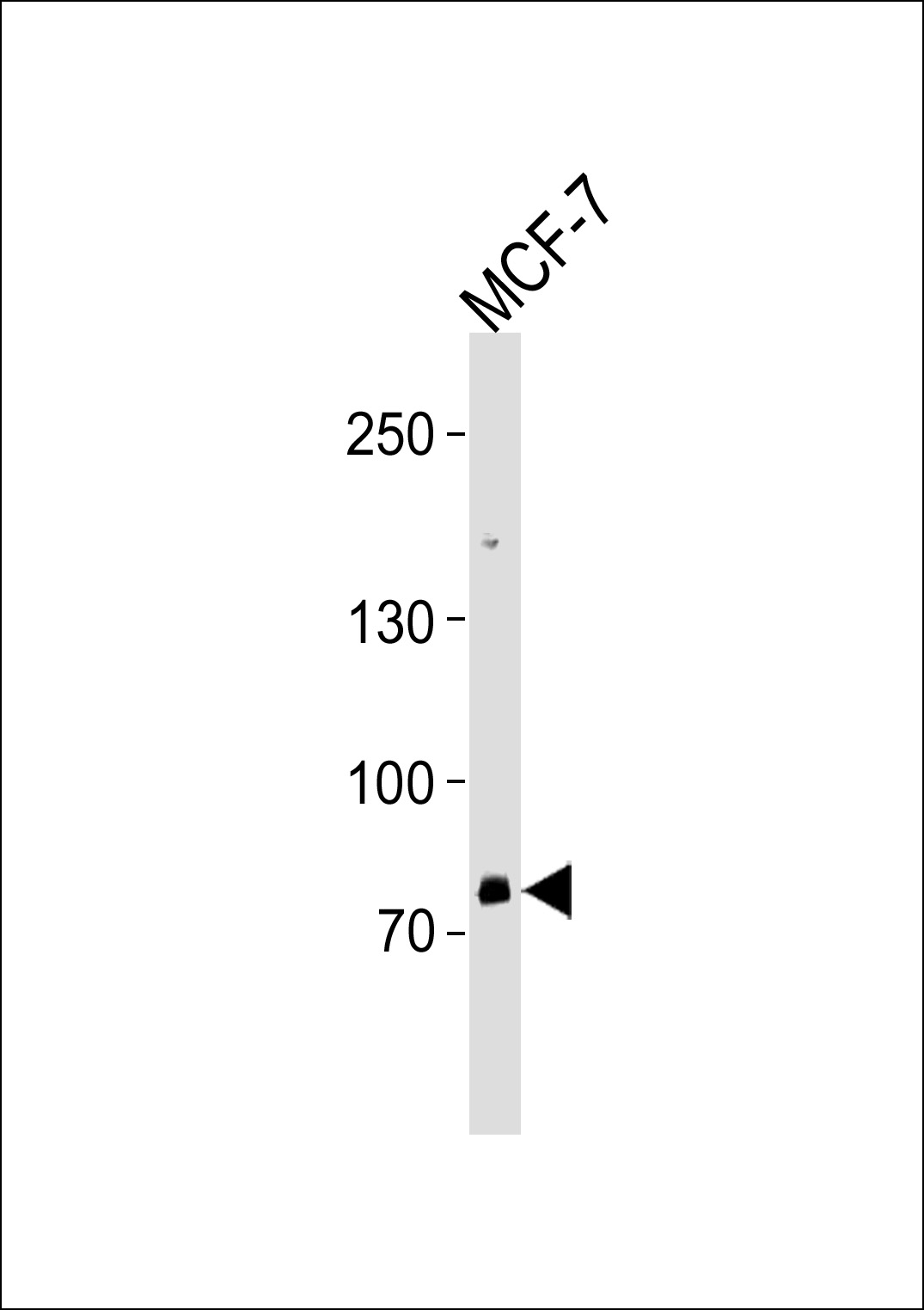 Rabbit Polyclonal Antibody to ZNF483