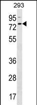 Rabbit Polyclonal Antibody to ZNF416