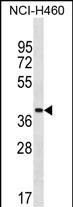 Rabbit Polyclonal Antibody to ZNF488