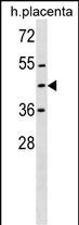 Rabbit Polyclonal Antibody to ZNF558