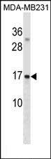 Rabbit Polyclonal Antibody to GABARAPL3