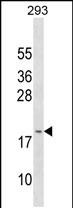 Rabbit Polyclonal Antibody to GAGE3 (N-term)