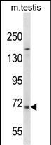 Rabbit Polyclonal Antibody to EXTL1