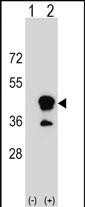 Rabbit Polyclonal Antibody to CD1B (N-term)