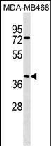 Rabbit Polyclonal Antibody to ABHD1