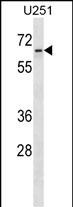 Rabbit Polyclonal Antibody to ZNF768 (N-term)
