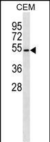 Rabbit Polyclonal Antibody to B4GALT4