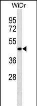 Rabbit Polyclonal Antibody to ERLIN2